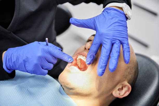 Best Emergency Wisdom Tooth Extraction in Bear Creek, FL