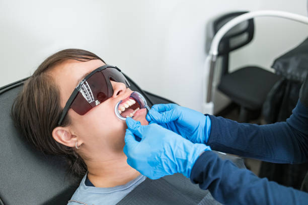 Best Knocked-Out Tooth (Avulsed Tooth) Treatment in Bear Creek, FL