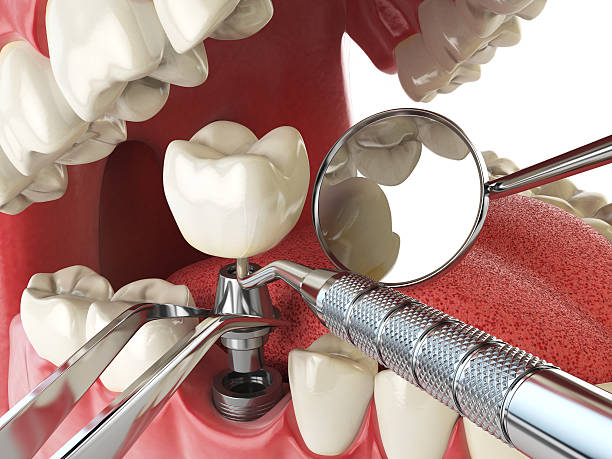 Best Emergency Treatment for Jaw Pain or Injury in Bear Creek, FL